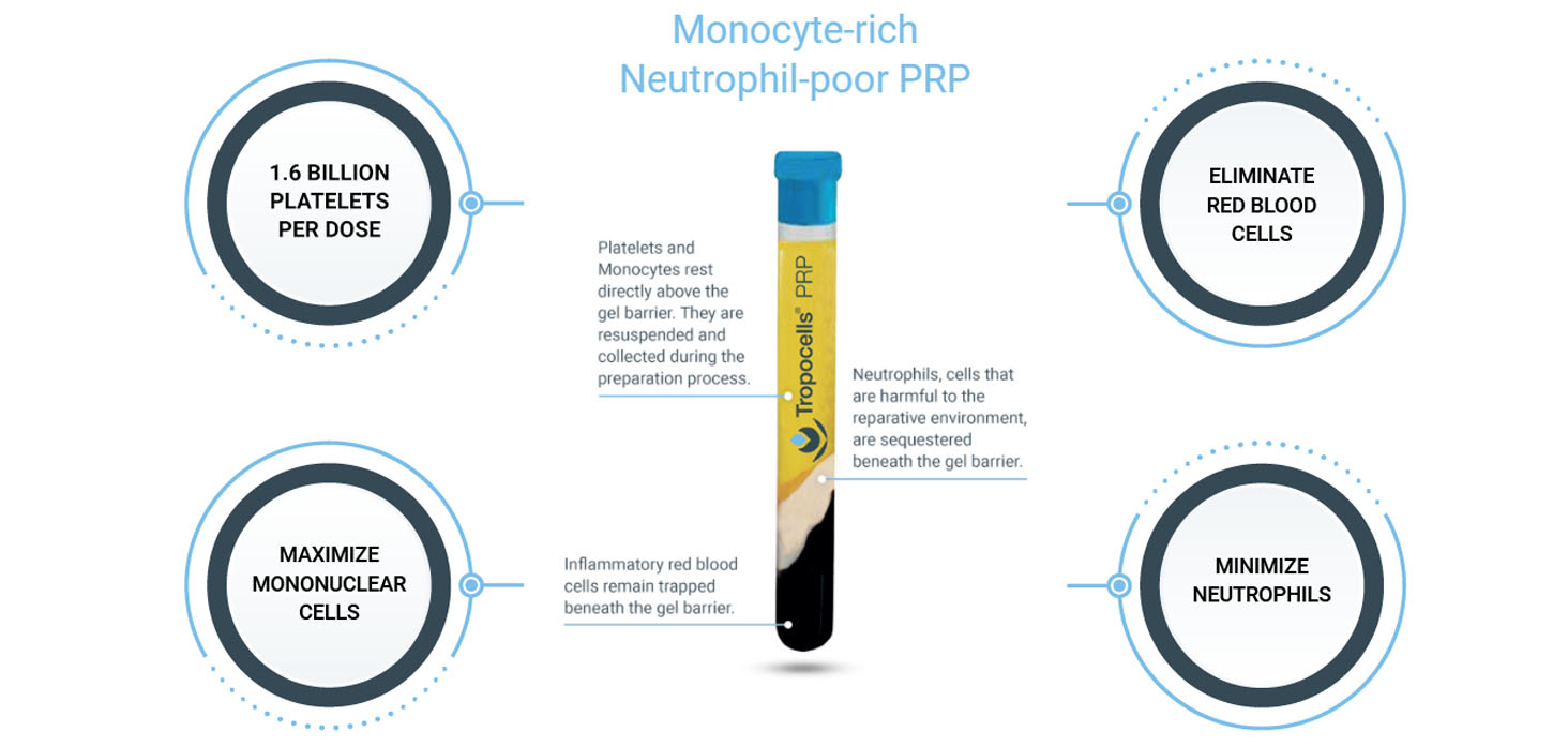 Tropocells PRP Tropocells PRP