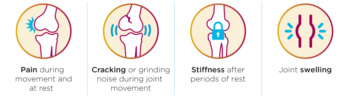 Suplasyn® for Patient - Premier Surgical